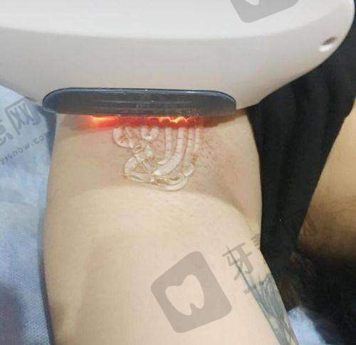 脱毛在哪个软件预约更容易踩坑?3大陷阱+避坑话术