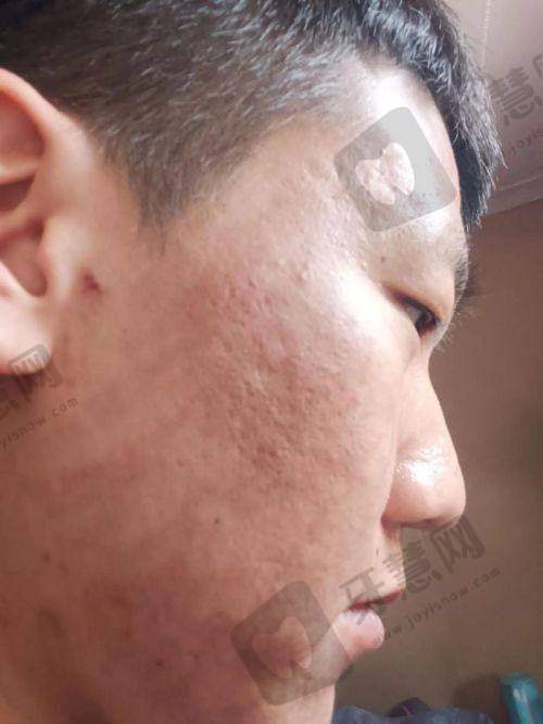 皮肤科在线询问免费24小时避坑指南：这3类“免费询问”千万别信！