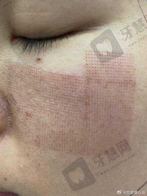皮肤科在线询问免费24小时问诊攻略：医生更常问这3个问题，提前准备好能省一半时间