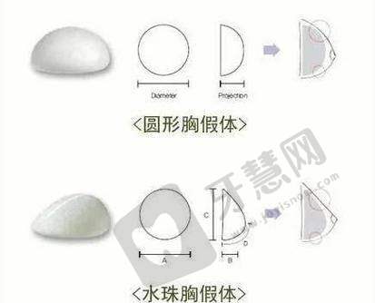 隆胸预约挂号指南：在线锁定国内内窥镜技术医生，附地区挂号入口