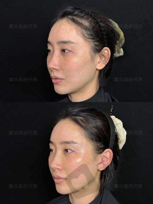 李芙蓉医生的口碑评价及反馈内容