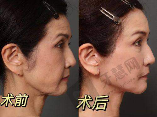 李芙蓉医生擅长的医美项目