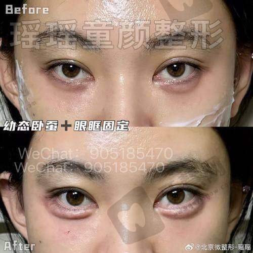 淡斑报名预约全流程:5步搞定,在家就能约