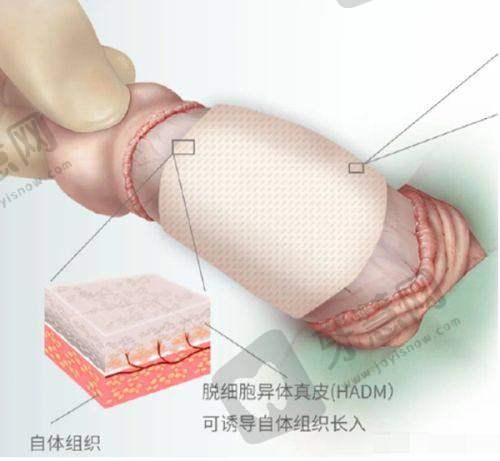 口腔科在线询问免费之种植牙专项：半价名额、材料对比，在线就能算预算