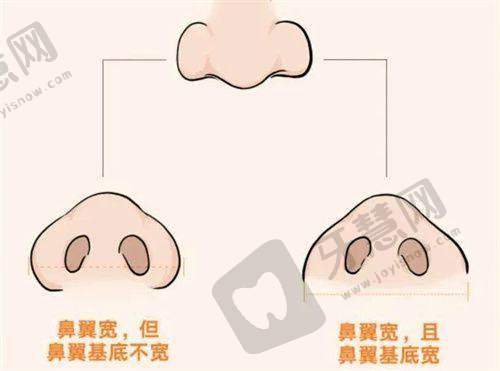 理性提醒：祛斑在线询问≠确诊，更终方案以面诊为准