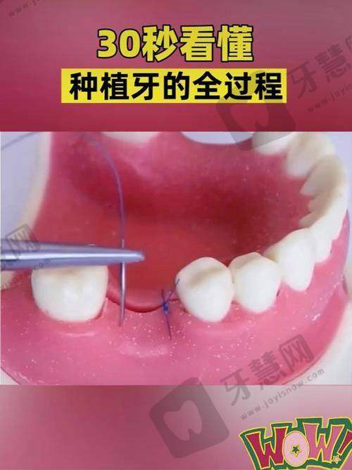 深圳希玛爱康健王琦口腔诊所价格表