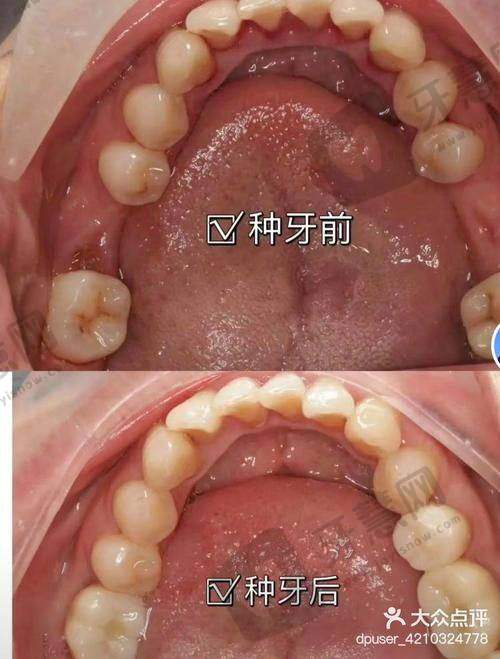 深圳希玛爱康健王琦口腔诊所患者评价