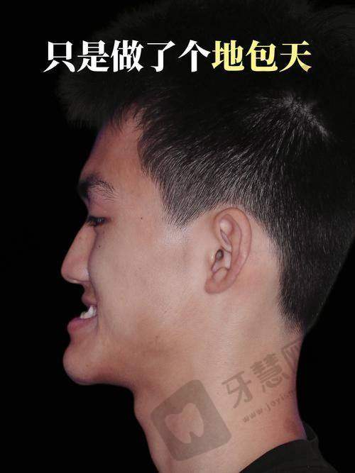 深圳御齿口腔门诊部顾客实例情况