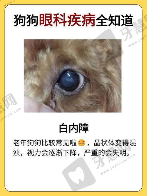 西安近视眼手术医院排名榜揭晓：西京、交大一附二院等，口碑技术双优值得选！