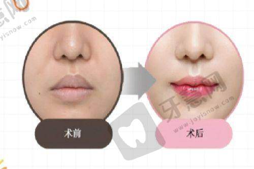男科一对一免费询问：更常被问到的6个“灵魂问题”