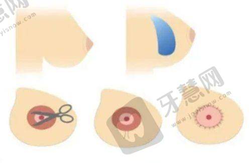 深圳景田万晓楠3S人鱼体雕不同项目价格区间是多少？