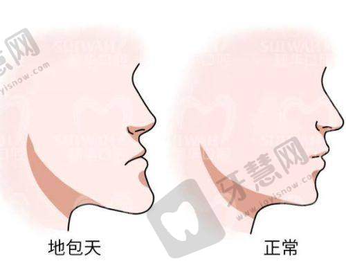 曲靖美莱口腔医院价格表
