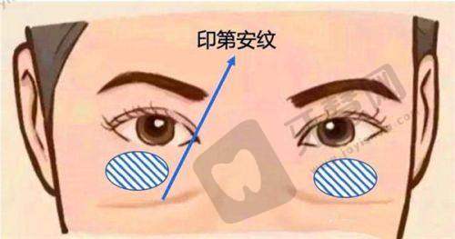 陈圣英医生怎么挂号预约