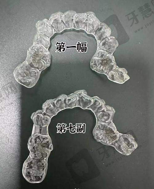 曲靖宣威爱牙仕口腔门诊部顾客实例