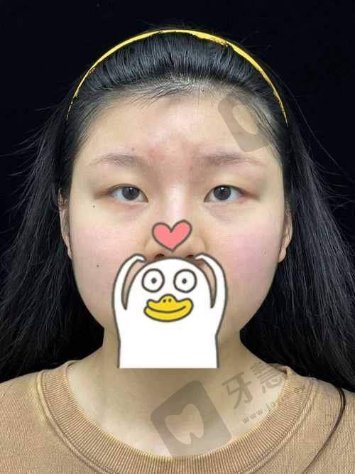 周云超医生收费标准