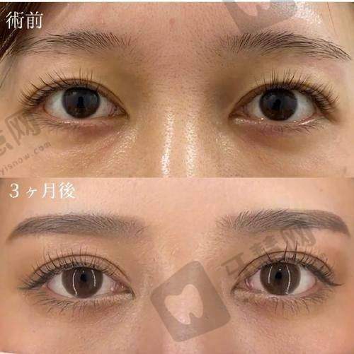 三、夏成俊医生做手术价格