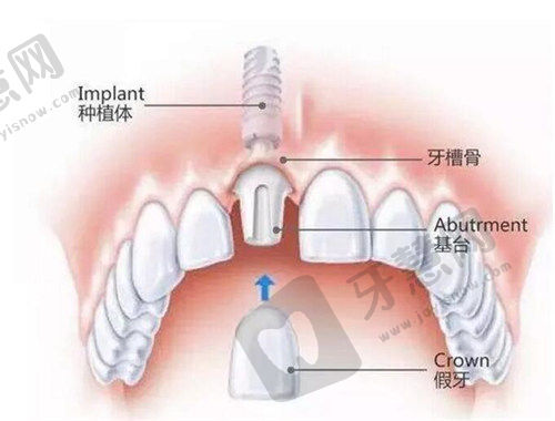 苏州英博口腔地址在哪？5家分店地址/电话/价格/口碑评价全揭秘