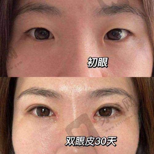 七、北京艺星王博谦美眼大师手术价格如何？