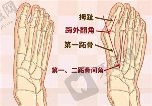女性私密整形术的并发症有哪些？成都棕南3D生物束带术无并发症多年有效