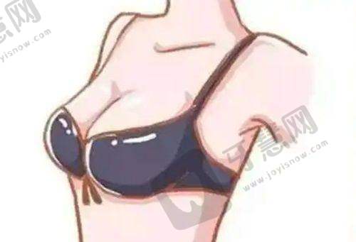 芜湖伊莱美隆胸吸脂优势