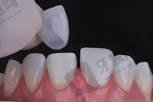 西安瑞泰口腔医院怎么样？二级连锁资质+数字化正畸种植口碑佳