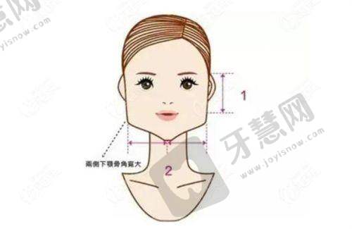 王一峰肋骨鼻手术优势展现