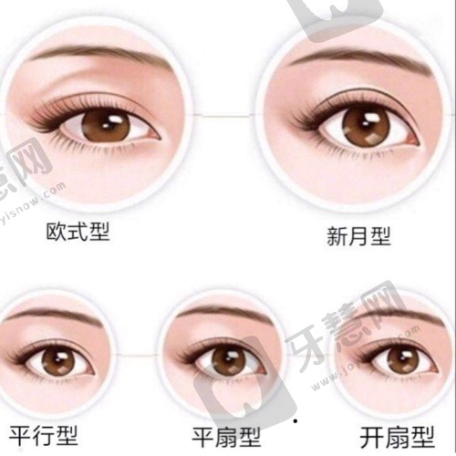 芜湖伊莱美和壹加壹哪家好？看隆胸吸脂选伊莱美眼鼻整形选壹加壹