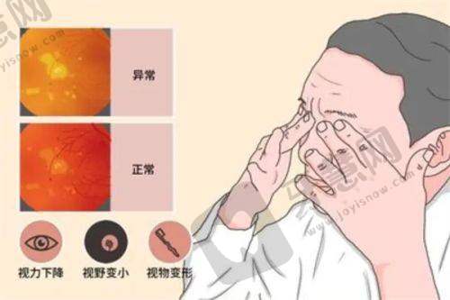 北京同仁医院眼科骨干医生排名揭晓：近视骨干医生排名