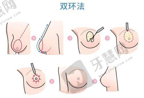 北京八大处口腔科牙齿美容项目收费明细是啥？