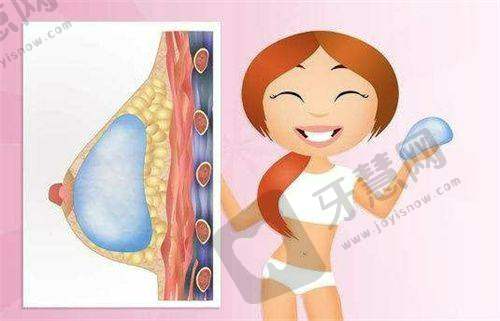 疤痕问题会导致做腹壁整形术后后悔吗？