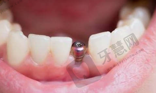 北京欢乐太阳宫口腔门诊部顾客实例