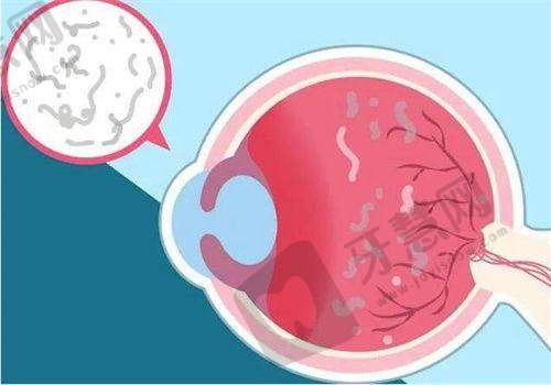 【陆军军医大学西南医院眼科近视手术价格表】2025多少钱?全飞秒|半飞秒|ICL晶体植入费用明细一览