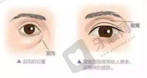 五、武汉同济医院鼻翼整形价格在武汉同济鼻综合价格表中的呈现