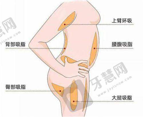 二、美丽佳人医美医院关于额头川字纹怎么消除