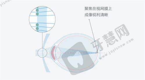 段安丽在北京哪些医院出诊之熙仁眼科医院优势