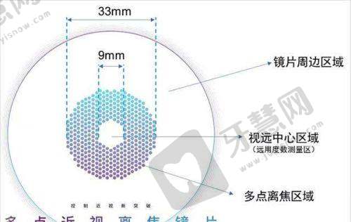 二、遵义医 科 大学附属医院眼科近视手术价格表背后的医院实力