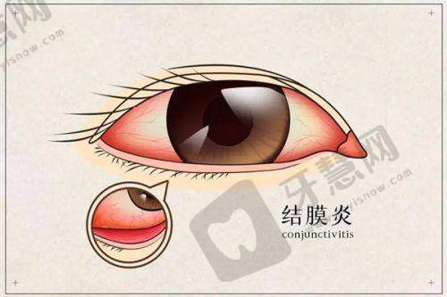 哈尔滨爱尔眼科医院在近视手术方面有多牛?