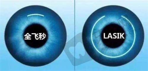 陆 军军 医 大学西 南医院眼科近视手术价格表中的热门项目解析——全飞秒1.8万值不值?