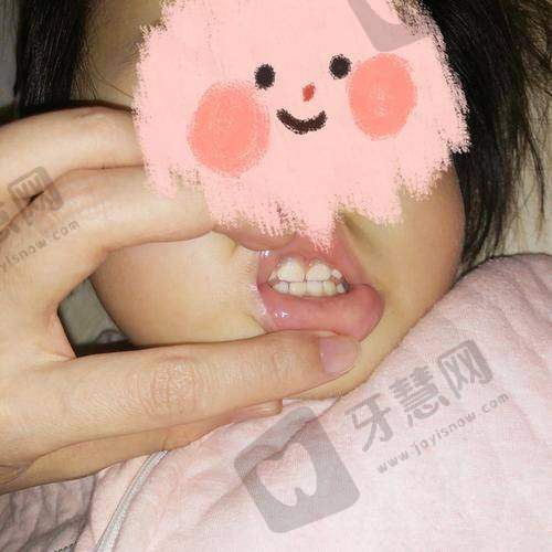 七、北京欢乐菲凡口腔门诊部顾客实例