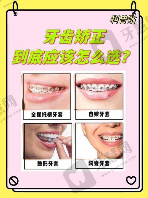 北京欢乐博瑞口腔门诊部价格表