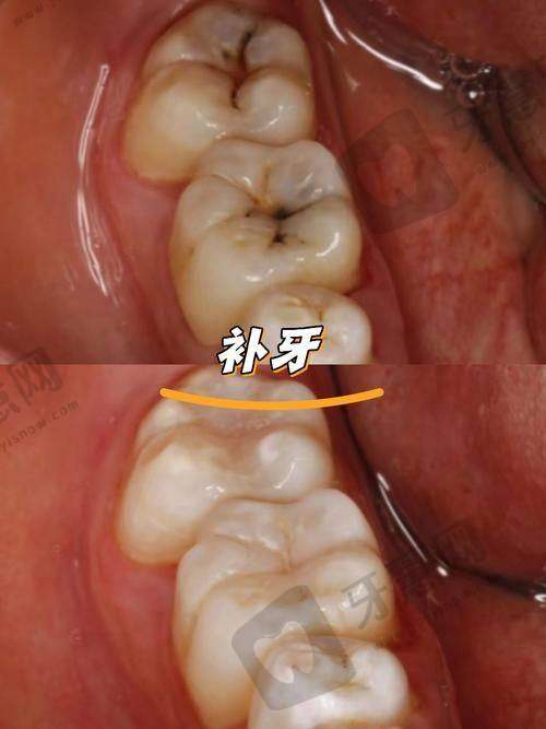 李治宇医生顾客实例图片