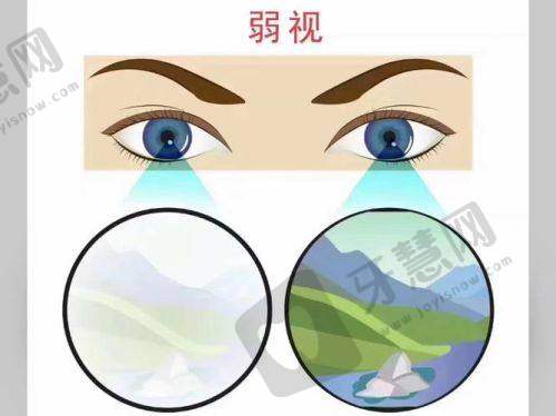 中山大学附属第一医院眼科预约挂号网到院预约流程:适合紧急情况,现场挂号攻略