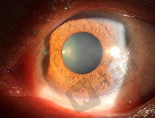 河北二院眼科就诊地址 + 交通指南:打电话预约后,这样去更方便