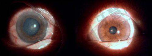 末尾说两句:河北二院眼科24小时电话,就是全家人的“眼健康管家”