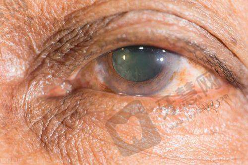 【辽宁省人民医院眼科预约挂号电话】2025最新！附专家门诊/挂号方式咨询号源查询（实时更新）