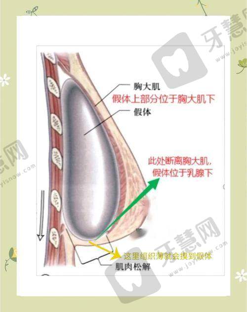 沈阳杏林整形医院项目价格表更新：鼻部整形1.2万起，半肋和超肋怎么选？看完不纠结！