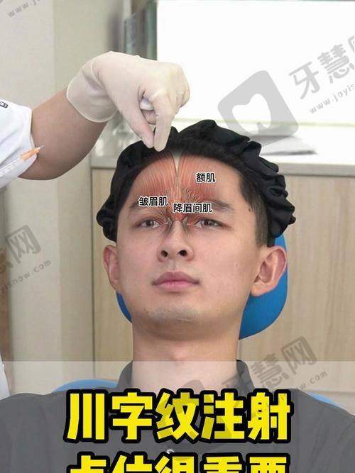 额头川字纹怎么消除的靠谱治疗方法之北京谢宏彬内窥镜除皱