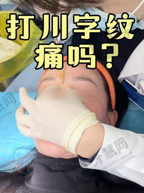 额头川字纹怎么消除的靠谱治疗方法之注射除皱针