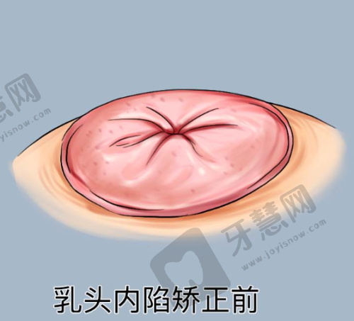 武汉铂雅医疗美容门诊部地址电话及营业时间:
