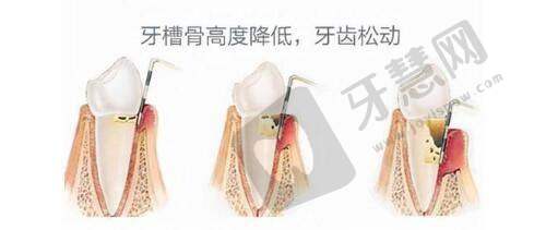 武汉熙朵植发医院地址电话及营业时间: